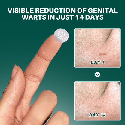 Cvreoz® Genital Wart Removal Patch – Now 60% OFF | Pain-Free, Clinically Proven Solution