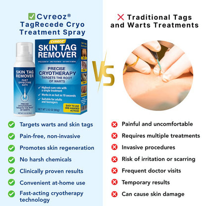 🔥HOT SALE 50% OFF💥 Cvreoz® TagRecede Cryo Treatment Spray