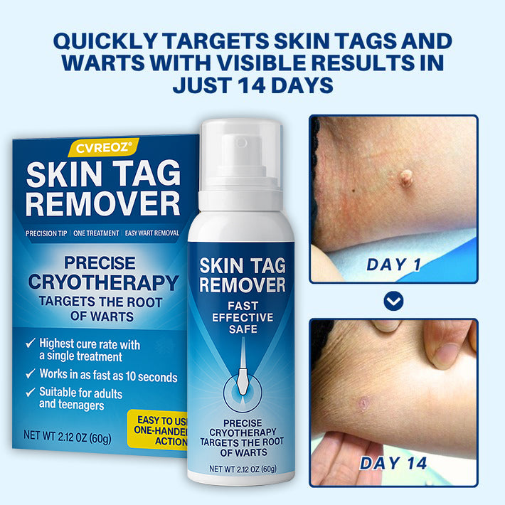 🔥HOT SALE 50% OFF💥 Cvreoz® TagRecede Cryo Treatment Spray