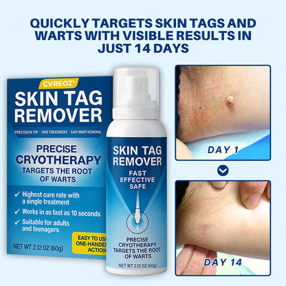 🔥HOT SALE 50% OFF💥 Cvreoz® TagRecede Cryo Treatment Spray