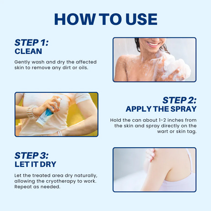 🔥HOT SALE 50% OFF💥 Cvreoz® TagRecede Cryo Treatment Spray