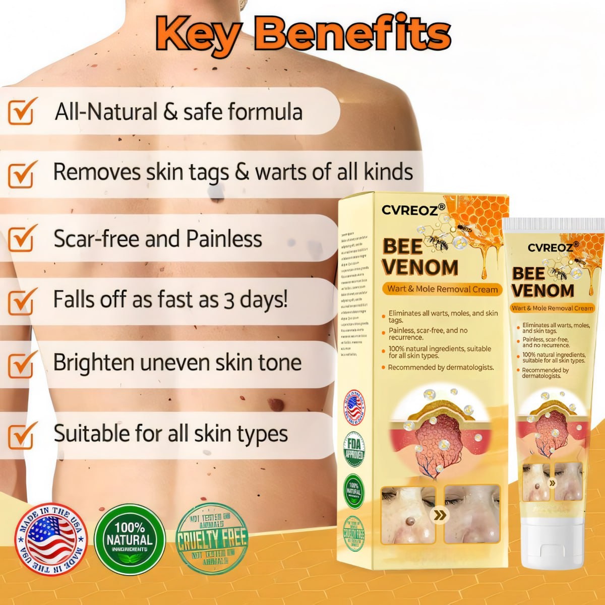 🎉SPECIAL OFFER: 60% OFF This Week Only!🔥CVREOZ® Skin Tag Bee Venom Treatment Cream