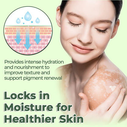 🔥LAST DEAL: 60% OFF🔥 Cvreoz® Vitiligo Treatment Ointment