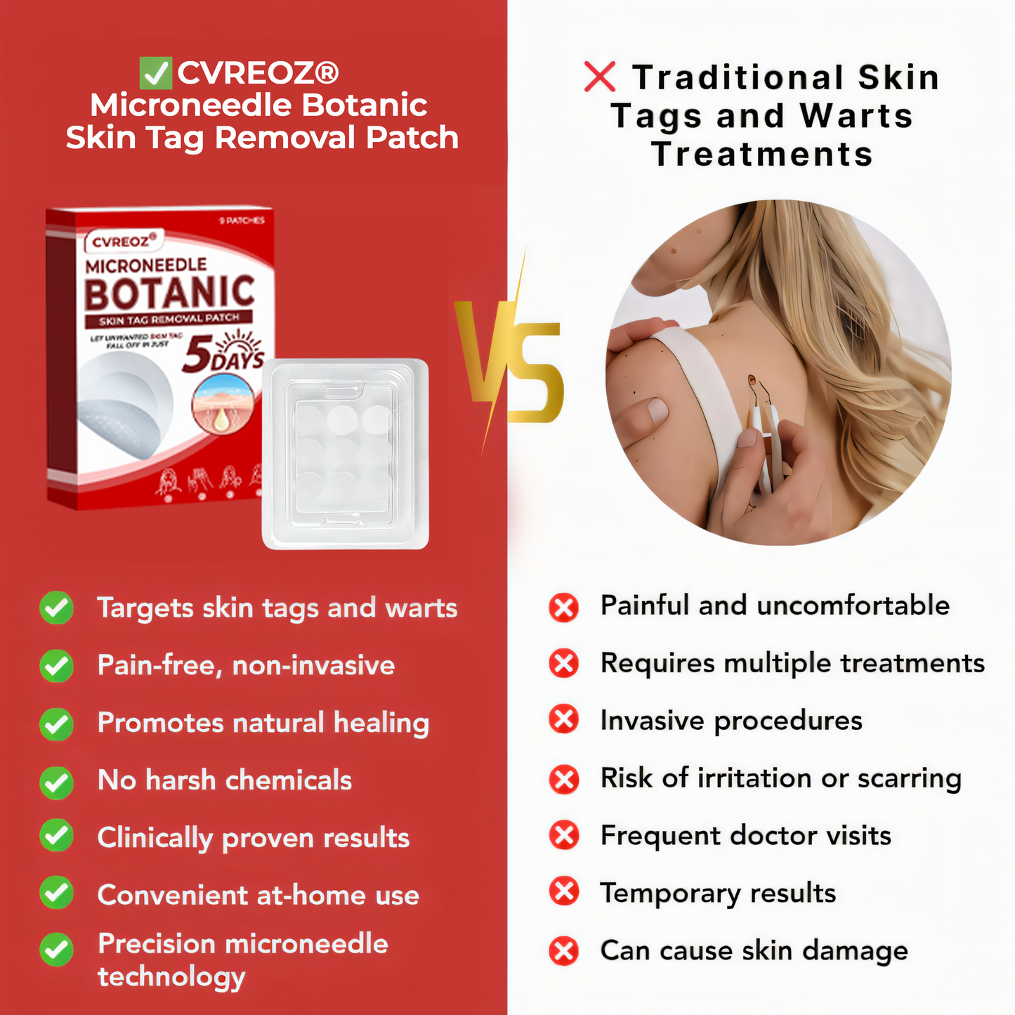 🔥 Last Day: 60% OFF ⏰ CVREOZ® Microneedle Botanic Skin Tag Removal Patch
