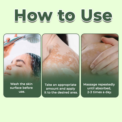 🔥LAST DEAL: 60% OFF🔥 Cvreoz® Vitiligo Treatment Ointment