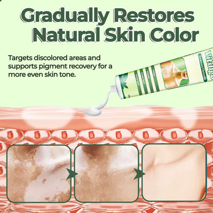 🔥LAST DEAL: 60% OFF🔥 Cvreoz® Vitiligo Treatment Ointment
