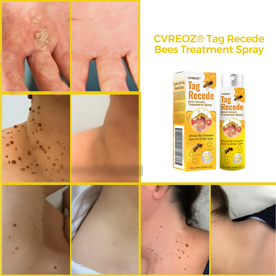 ⏰SPECIAL OFFER: 60% OFF Today ONLY!🔥🐝Cvreoz® TagRecede Bee Treatment Spray