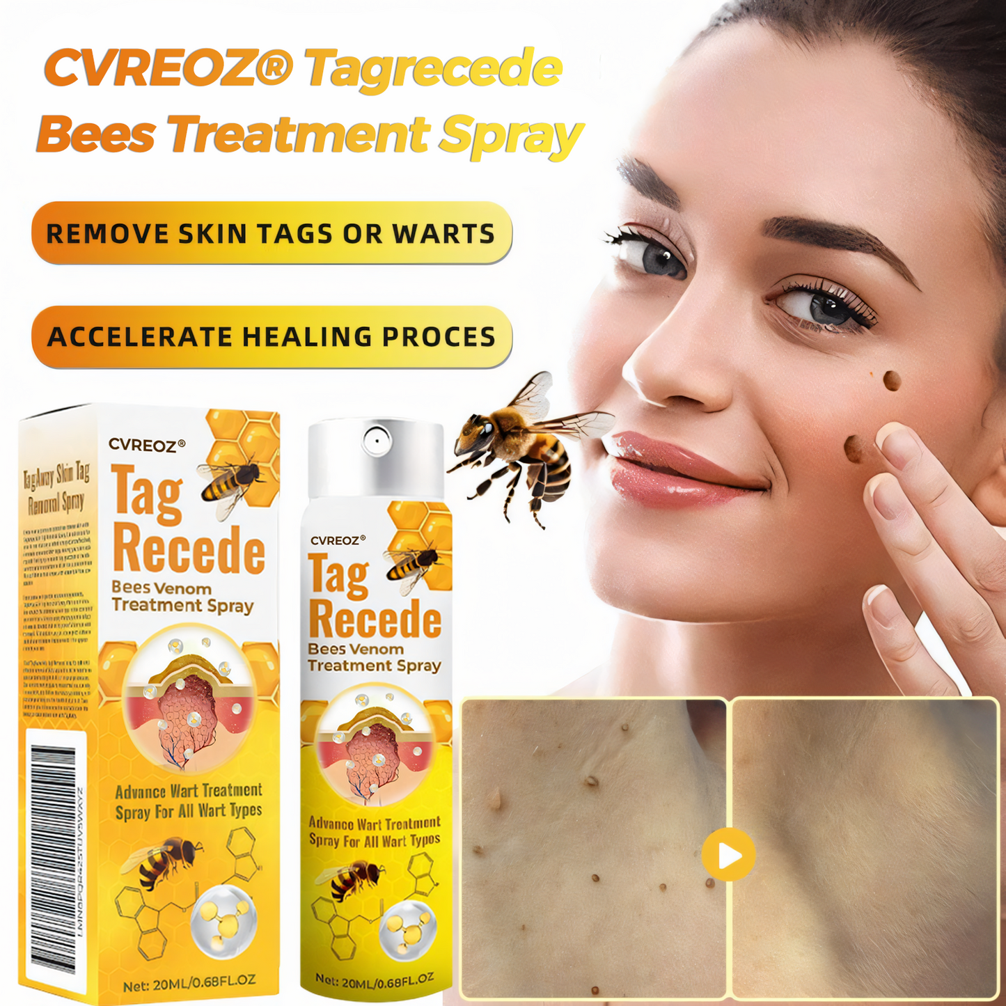 ⏰SPECIAL OFFER: 60% OFF Today ONLY!🔥🐝Cvreoz® TagRecede Bee Treatment Spray