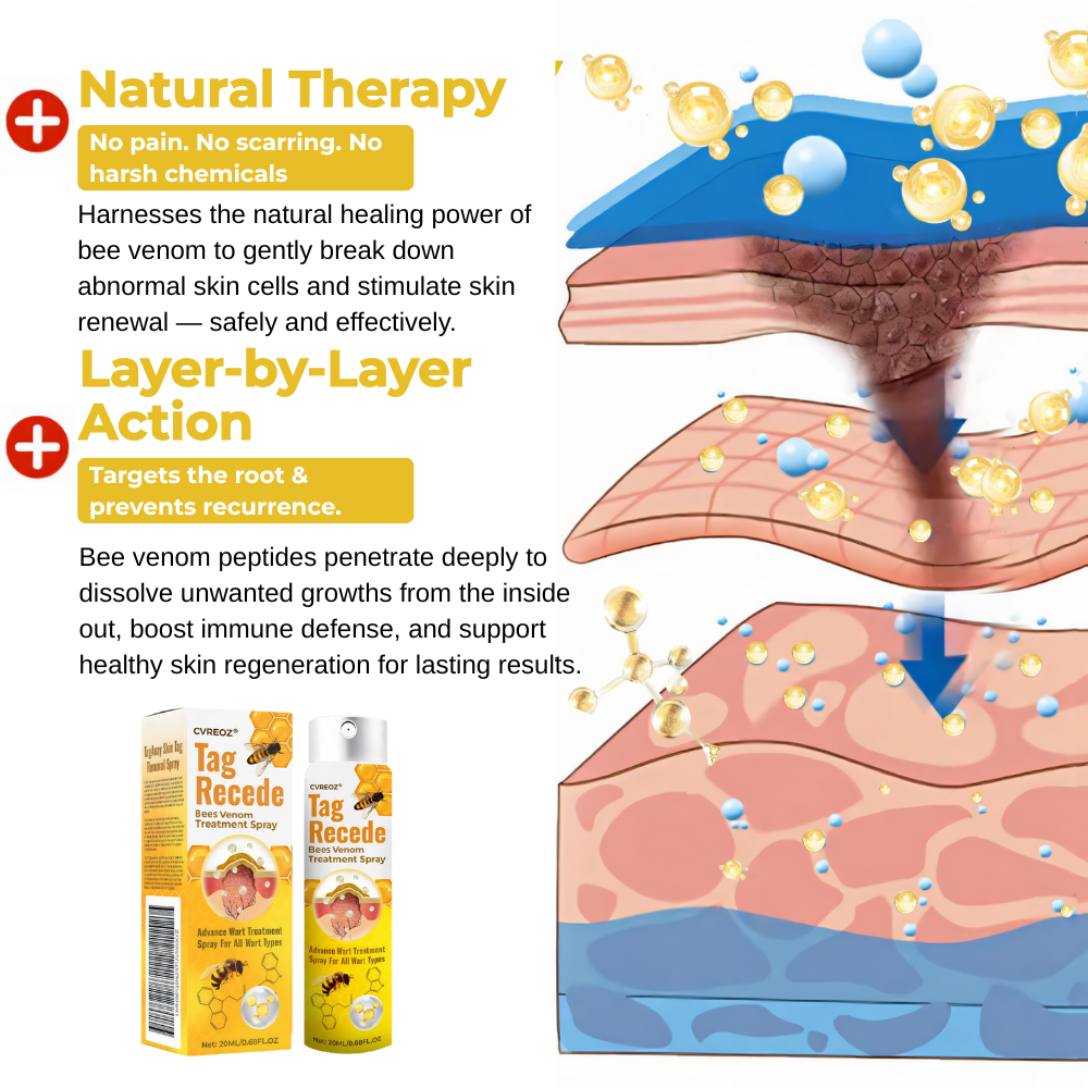 ⏰SPECIAL OFFER: 60% OFF Today ONLY!🔥🐝Cvreoz® TagRecede Bee Treatment Spray