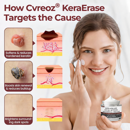 🔥Extra 40% Off 2nd Item!✨️ Cvreoz® KeraErase Dual-Action Renewal Cream