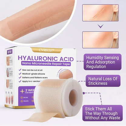 CVREOZ® Hyaluronic Acid Nano Microneedle Repair Tape⏰Limited Offer: Up to 60% OFF🔥