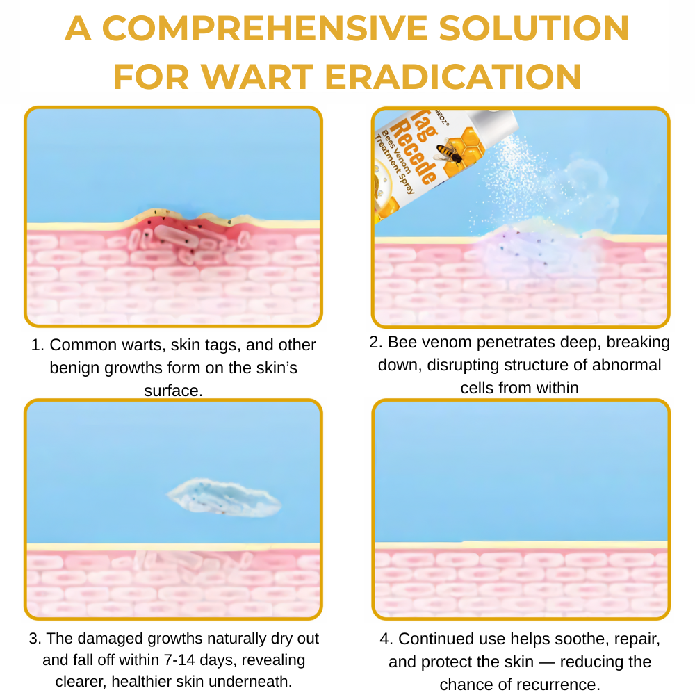 ⏰SPECIAL OFFER: 60% OFF Today ONLY!🔥🐝Cvreoz® TagRecede Bee Treatment Spray