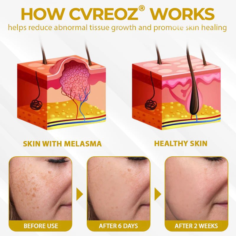 Cvreoz® MelanoCare Skin Rebalancing VitiBee Cream