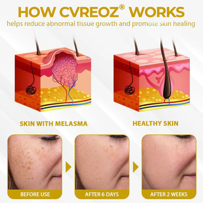Cvreoz® MelanoCare Skin Rebalancing VitiBee Cream