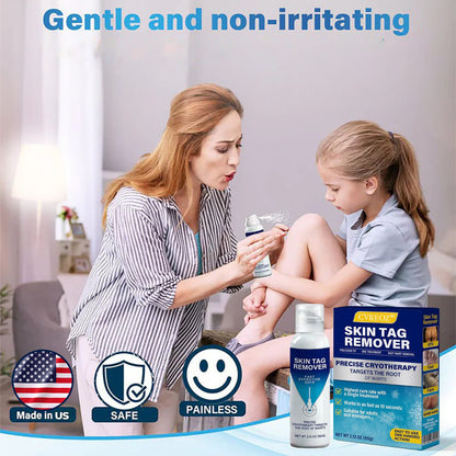 CVREOZ® TagRecede Cryo Treatment Spray🔥Last Deal: 60% Off🔥