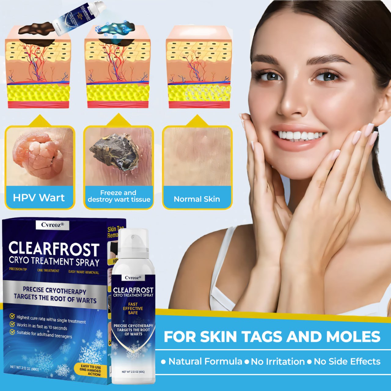 🔥HOT SALE: 70% OFF 🔥Cvreoz® ClearFrost Cryo Treatment Spray Pro