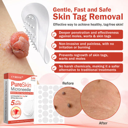 🔥HOT SALE: 60% OFF🔥Cvreoz® PureSkin Microneedle Botanic Patch