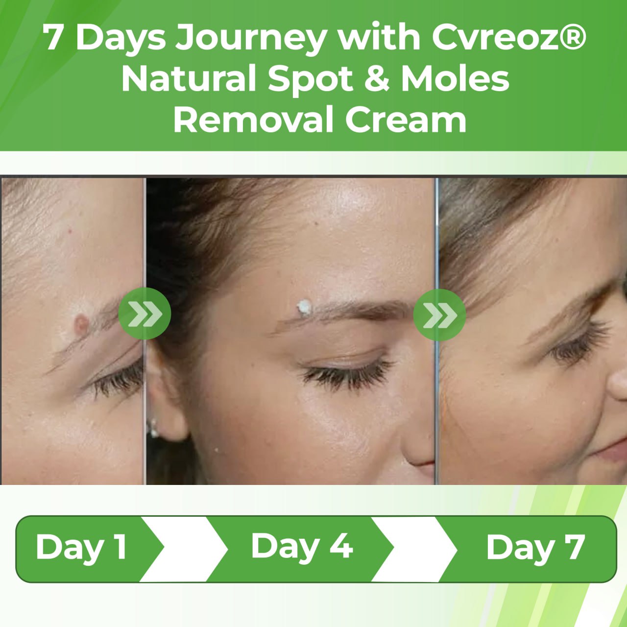 🔥HOT SALE: 60% OFF🔥Cvreoz® Natural Spot and Mole Removal Cream