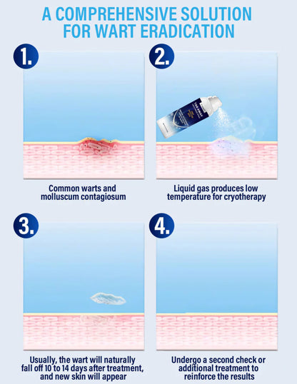 Cvreoz® TagAway Cryo Freeze Spray