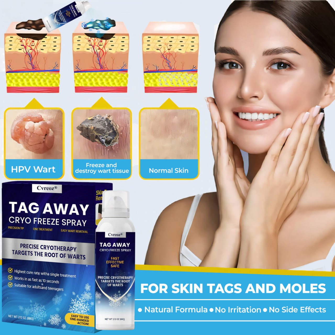 Cvreoz® TagAway Cryo Freeze Spray