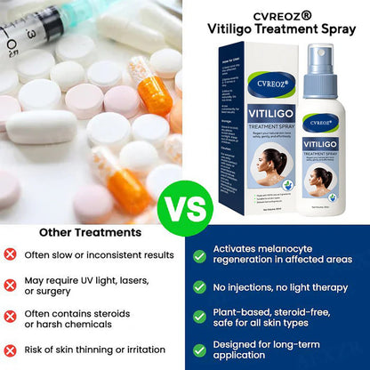 ⏰Limited Stock🔥Flash Sale 60% OFF🔥 Cvreoz® Vitiligo Treatment Spray