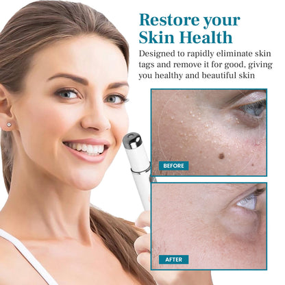 💫 Bikenda® Advanced LumeSkin Mole and Wart Removal Laser Pen 🔦 🔥 UP TO 60% OFF 🔥
