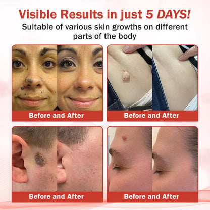 🔥HOT SALE: 60% OFF🔥Cvreoz® PureSkin Microneedle Botanic Patch
