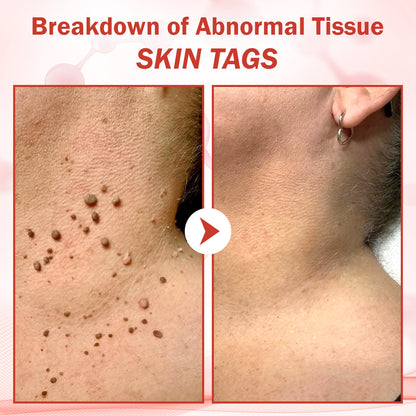 🔥HOT SALE: 60% OFF🔥Cvreoz® PureSkin Microneedle Botanic Patch