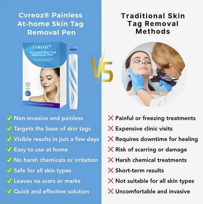 Cvreoz® Skin Tag Removal Pen