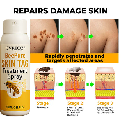 🎉SPECIAL OFFER: 60% OFF This Week Only!🔥 Cvreoz® BeePure Skin Tag Treatment Spray