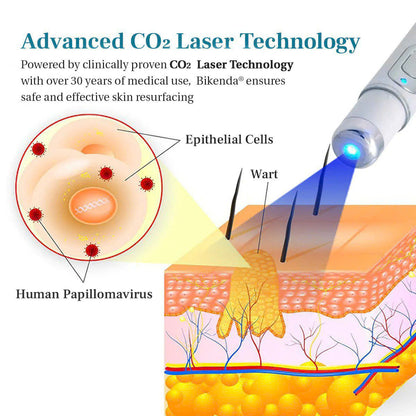 💫 Bikenda® Advanced LumeSkin Mole and Wart Removal Laser Pen 🔦 🔥 UP TO 60% OFF 🔥
